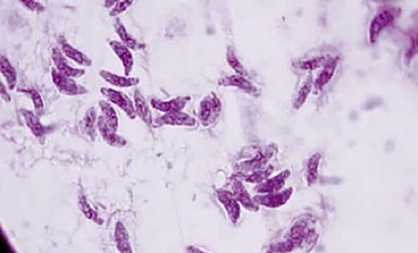 protozoaire parasitaire toxoplasma gondii l'agent causal de la toxoplasmose