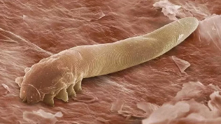 Les parasites dans le corps de l'homme